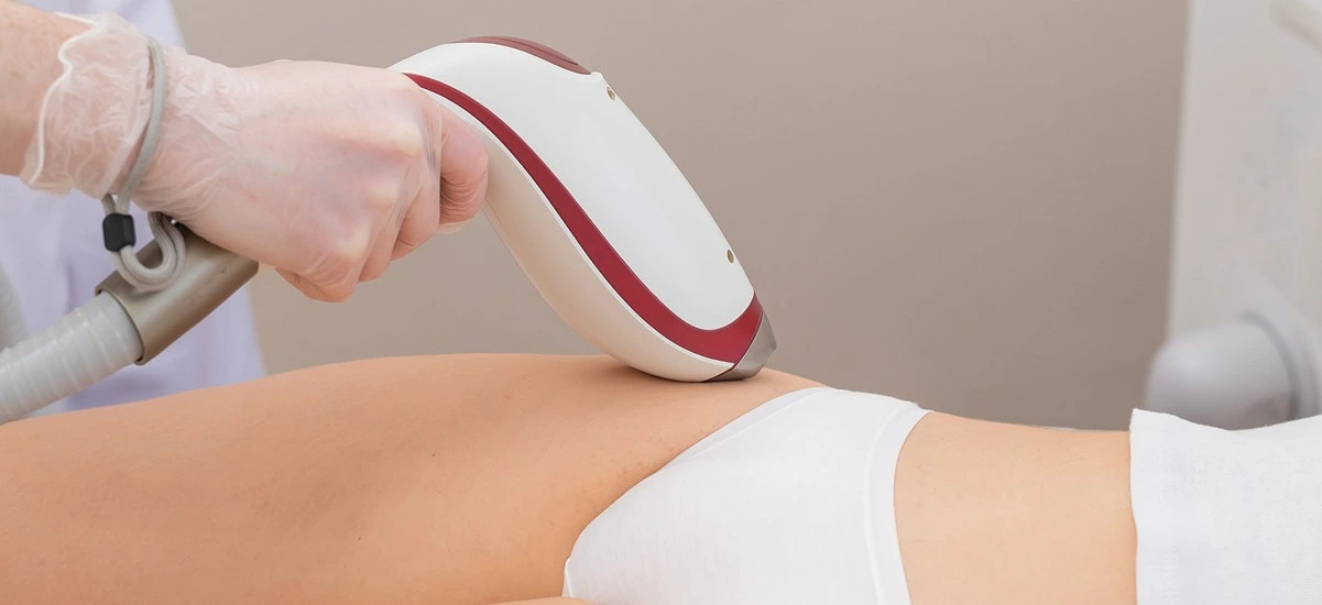 Brazilian Laser Hair Removal How Many Sessions