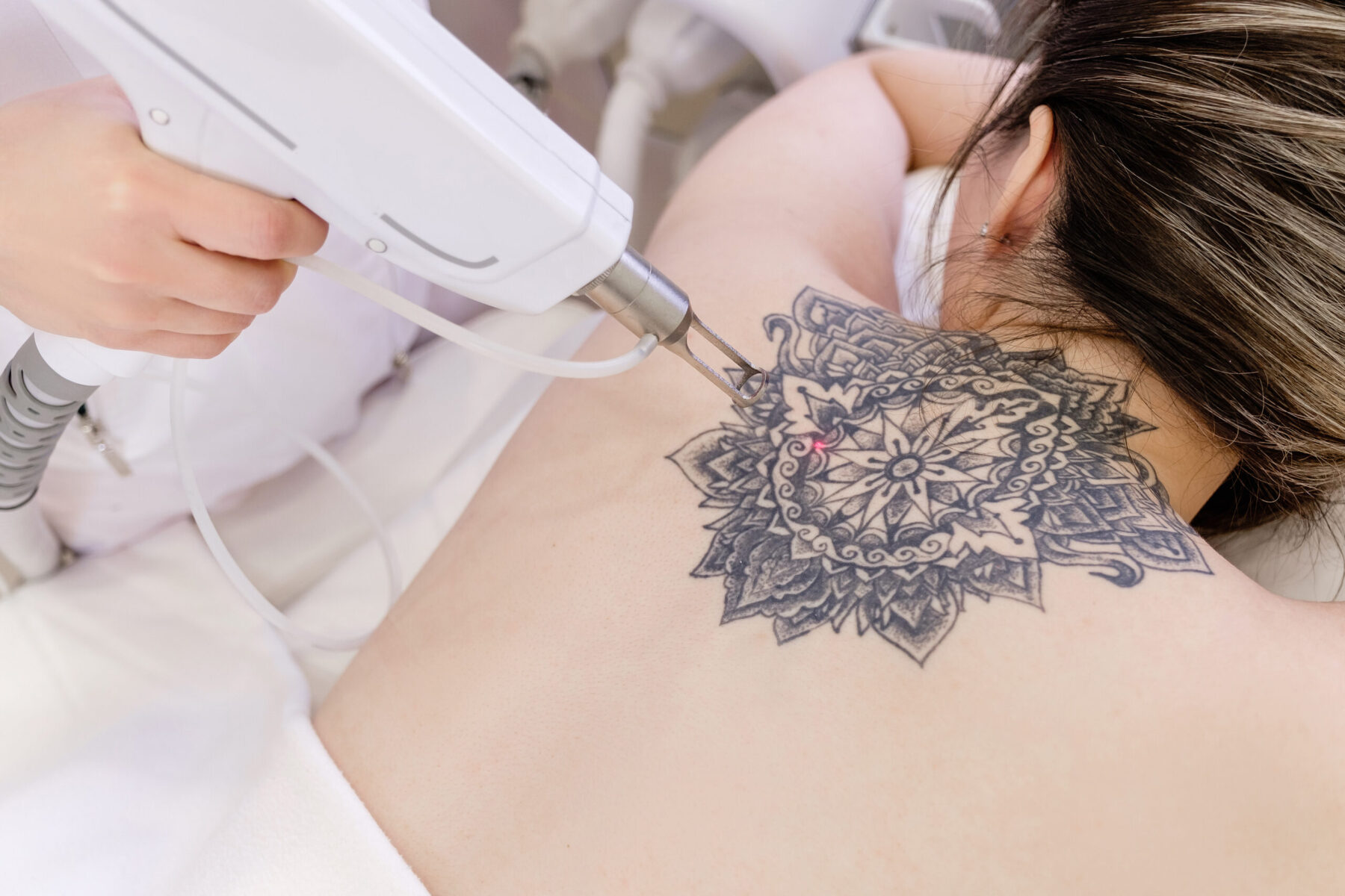 Can You Conduct Laser Hair Removal Over Tattoos?