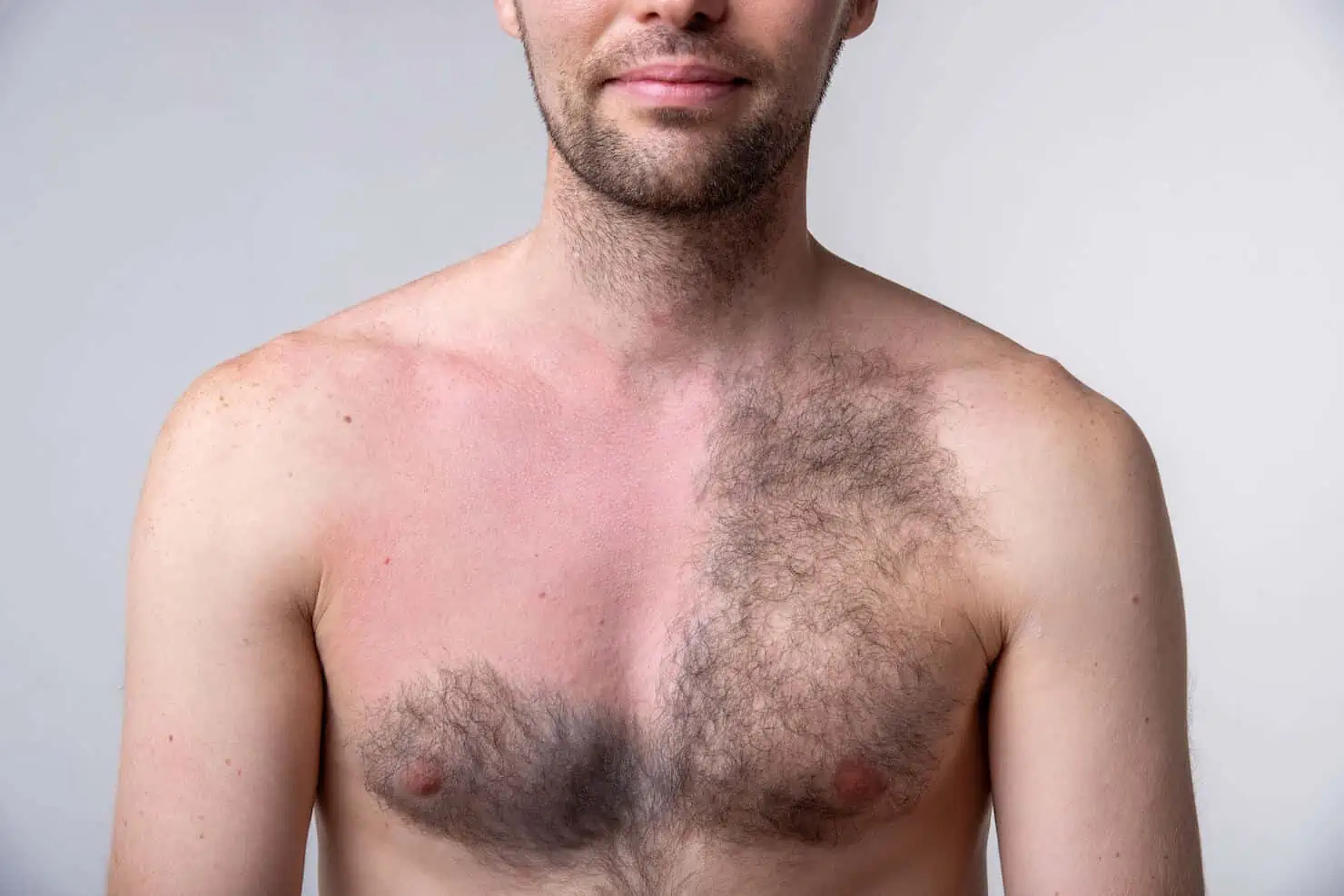 What Are The Most Frequent Hair Removal Requests From Men?