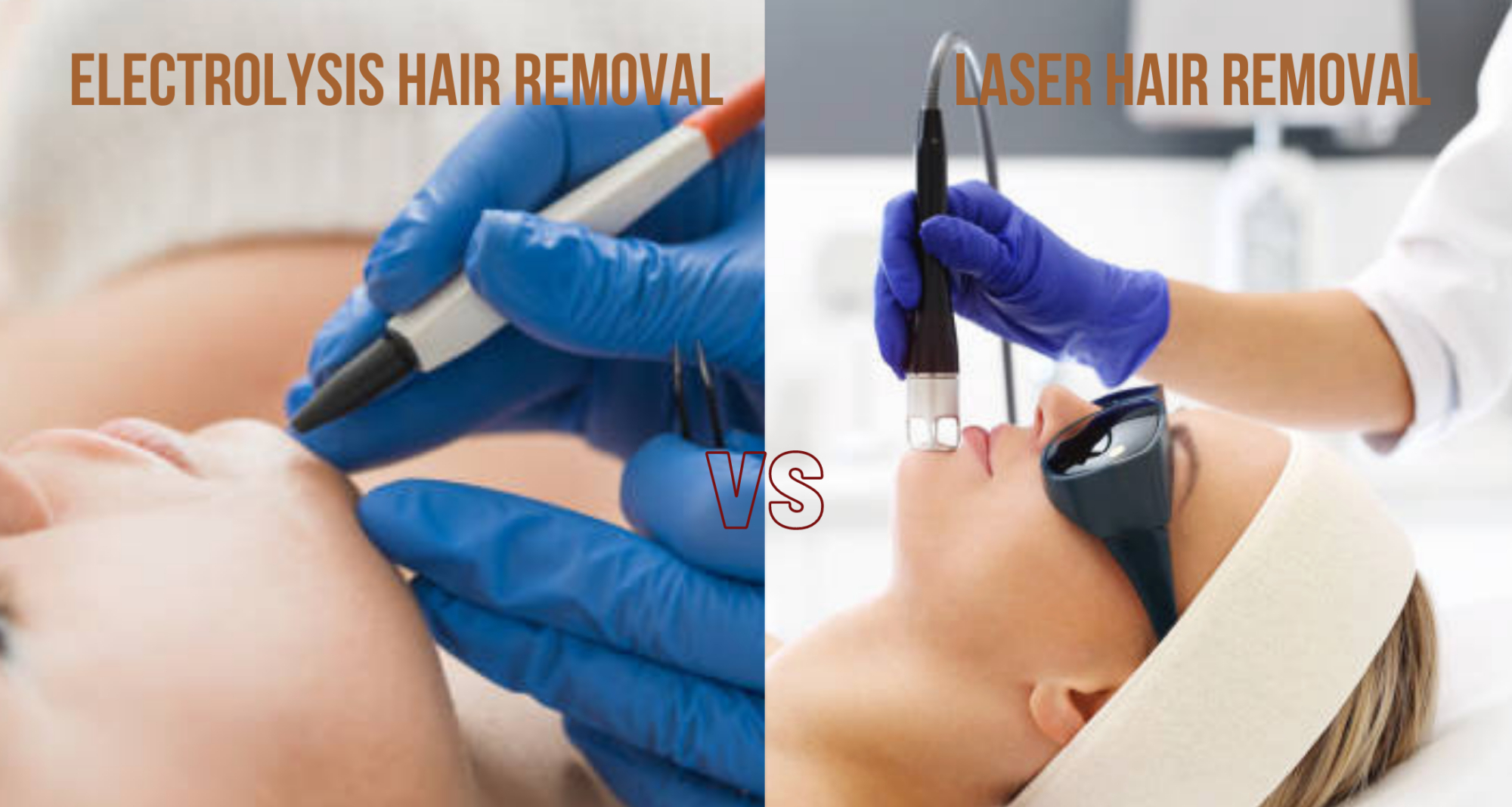 What Is The Difference Between Laser Hair Removal And Electrolysis