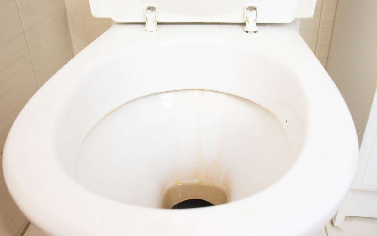 Why Does My Poop Stain The Toilet Yellow